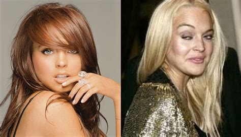 celebrities with bad plastic surgery results